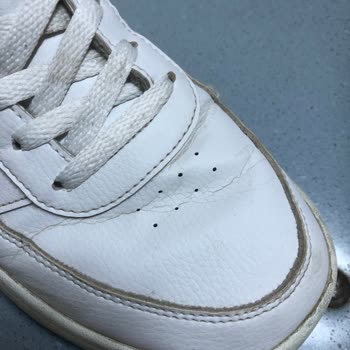 Adidas Ayakkabıda Garanti Sorunu Ve Deformasyon
