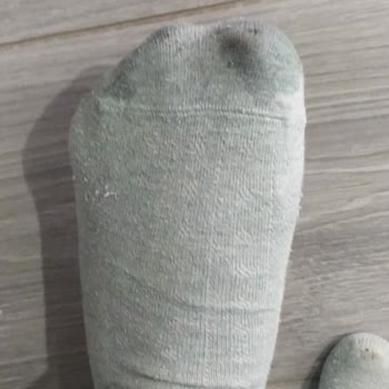 Deri Ayakkabı Su Aldı, Mağaza Çözüm Sunmuyor