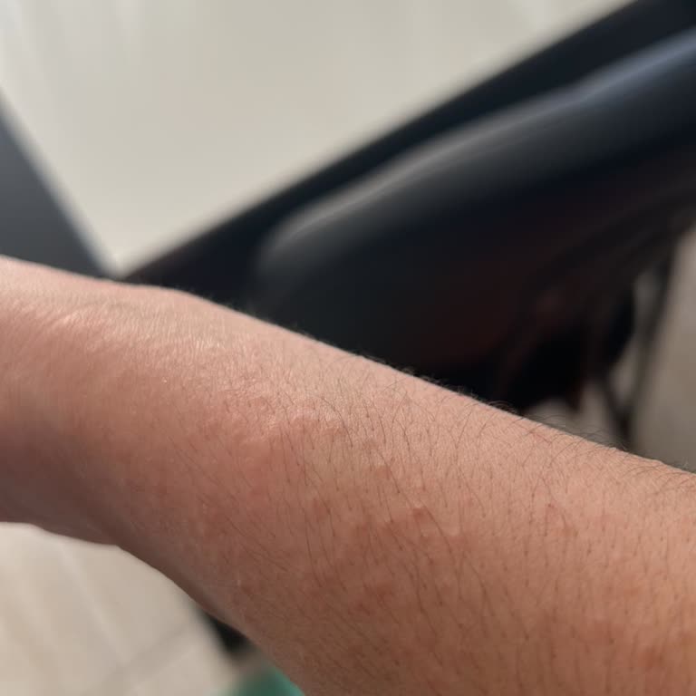 Nutraxin Nysa Her Yerimi Kabarttı