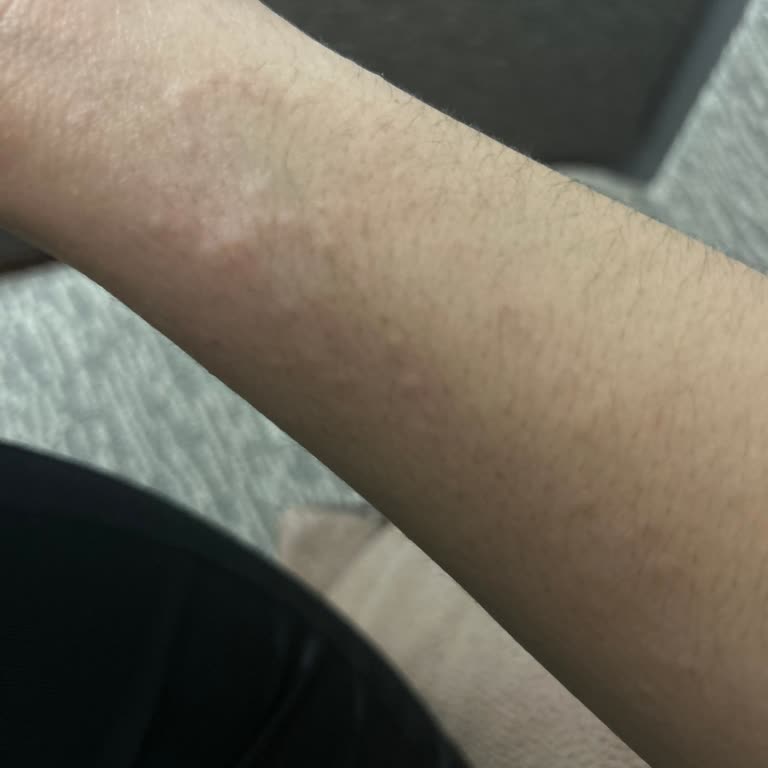 Nutraxin Nysa Her Yerimi Kabarttı