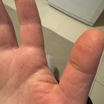 Fairy Platinum Bulaşık Deterjanı Ellerimi Mahvetti