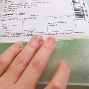 HP Laptop Garanti Sorunu Ve Haksız Ücret Talebi