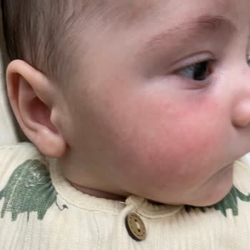 Bebek Ürünlerinde Beklenmedik Değişim Ve Cilt Sorunları