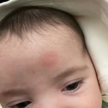 Bebek Ürünlerinde Beklenmedik Değişim Ve Cilt Sorunları