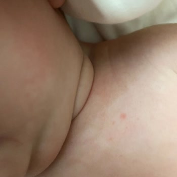 Bebek Ürünlerinde Beklenmedik Değişim Ve Cilt Sorunları