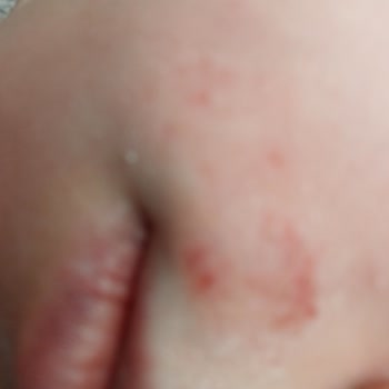 Sesu Yüz Ağda Bandı İle Yaşadığım Korkunç Deneyim