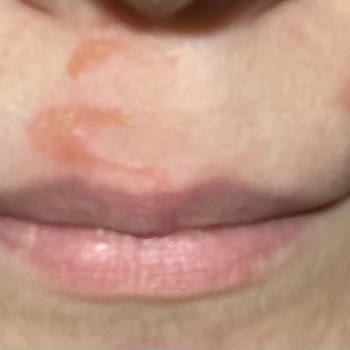 Sesu Yüz Ağda Bandı İle Yaşadığım Korkunç Deneyim