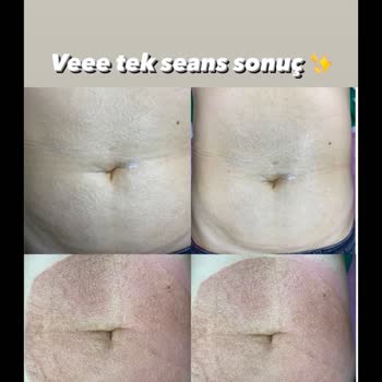Güzellik Merkezi İşlemimi Sahipleniyor!