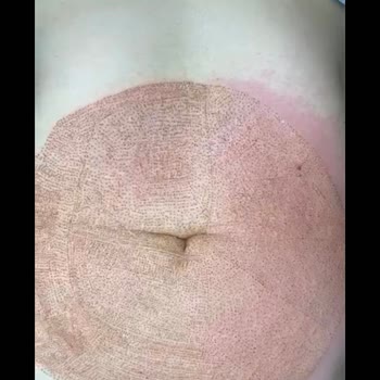 Güzellik Merkezi İşlemimi Sahipleniyor!