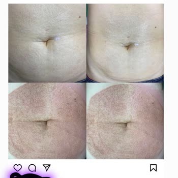 Güzellik Merkezi İşlemimi Sahipleniyor!