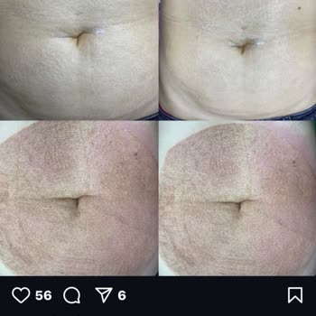 Güzellik Merkezi İşlemimi Sahipleniyor!