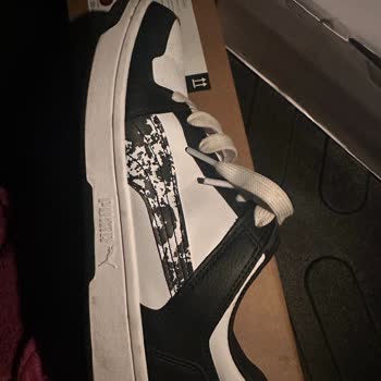 Ayakkabı Kalıbı Sorunu Nedeniyle Yaşanan Ağrı