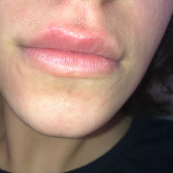 Cilt Ürünleri Sağlık Sorunlarına Yol Açıyor!