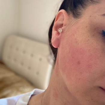 Yves Rocher Şampuanı Alerjik Reaksiyon Yarattı