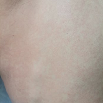 Berko İlaç Yan Etkilerle Mücadele: İlaç Kullanımında Yaş Sınırı Sorunu!