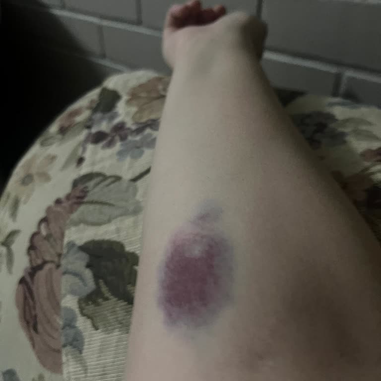 Acil Serviste Damar Yolu Açma Sorunu