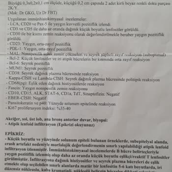 Yanlış Teşhis Ve Gecikme Yüzünden Hayatımız Karardı