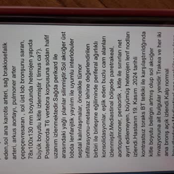 Yanlış Teşhis Ve Gecikme Yüzünden Hayatımız Karardı