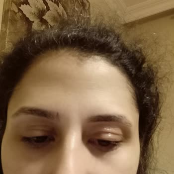 Ducray Dexyane крем для век вызвал покраснение и отек