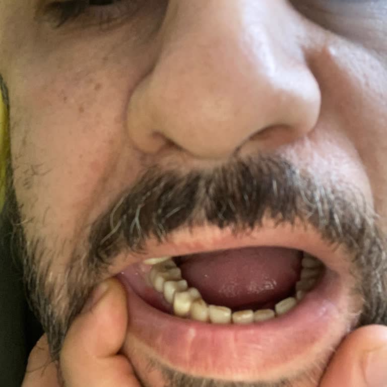 Dental Kliniğinde İlgisizlik Ve Eksik Hizmet