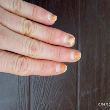 Flormar Turkuaz Oje Tırnaklarımı Turuncuya Boyadı