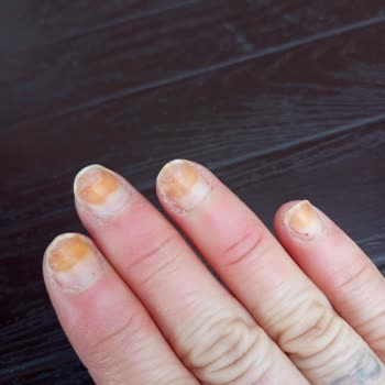 Flormar Turkuaz Oje Tırnaklarımı Turuncuya Boyadı