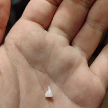 Kahve Dünyası Çikolatasında Tehlikeli Plastik Parça Şoku