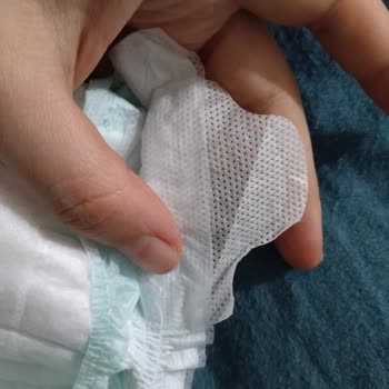 Bebek Bezinde Şehirler Arası Farklılık Sorunu