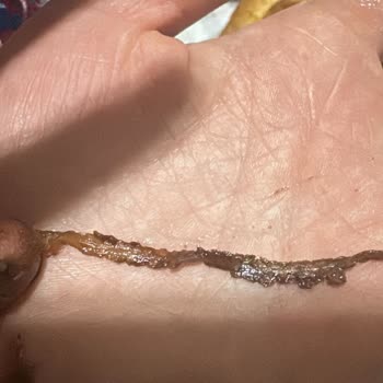 Ülker Fındık Rüyası'nda Beklenmedik Yabancı Madde Şoku