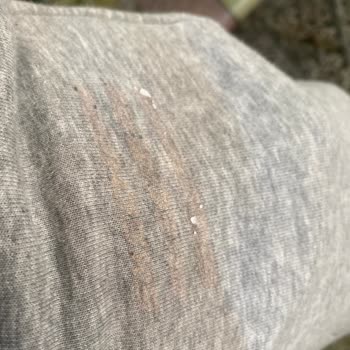 Skechers Shoes Fell Apart & Logo Faded on Sweatpants Within Months