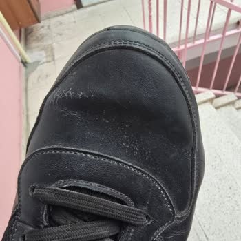 Skechers Shoes Fell Apart in Weeks—Defects Ignored