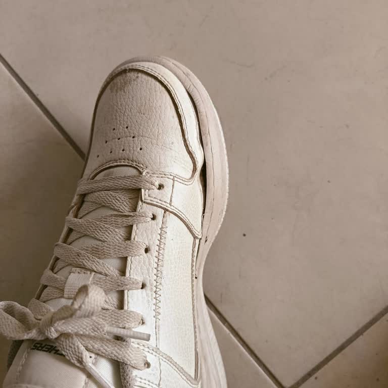 Skechers Ayakkabılarında Kalite Sorunları Ve Müşteri Hizmetleri Hayal Kırıklığı!