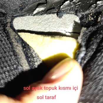 Skechers Ayakkabılarımın Dikişleri Ve Astarları Paramparça Oldu