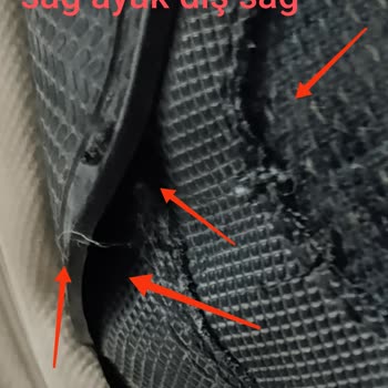 Skechers Ayakkabılarımın Dikişleri Ve Astarları Paramparça Oldu