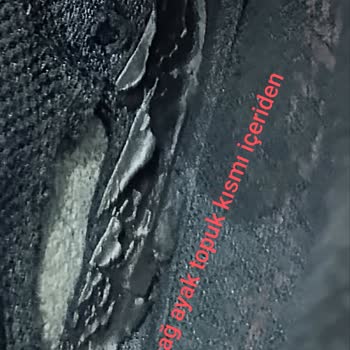 Skechers Ayakkabılarımın Dikişleri Ve Astarları Paramparça Oldu