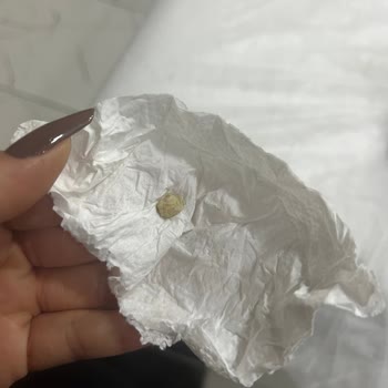 Ekmekten Çıkan Taşla Şok Oldum!