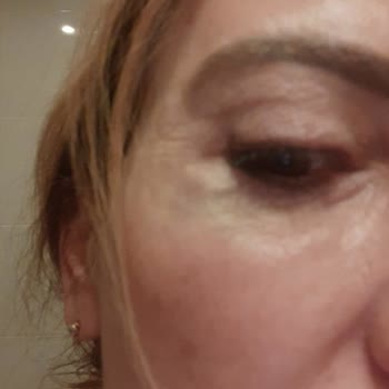 Estpoint Mağdur Oldum!