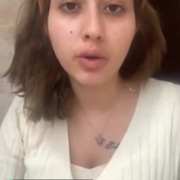 Apranax Ciltte Leke Yaptı!