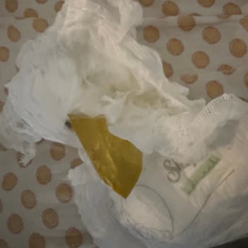 Bebek Bezi İçinde Kağıt Parçası Şoku