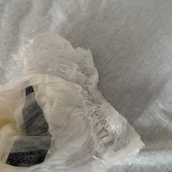 Bebek Bezi İçinde Kağıt Parçası Şoku