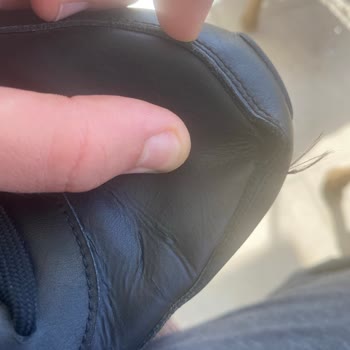 Skechers Ayakkabıda Dikiş Açılması Ve Garanti Reddi