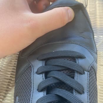 Skechers Ayakkabıda Dikiş Açılması Ve Garanti Reddi