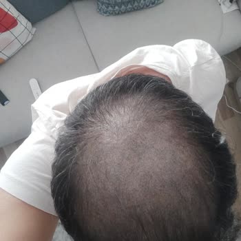 Eki aç