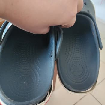 Crocs Terliklerim Beklenmedik Şekilde Parçalandı!