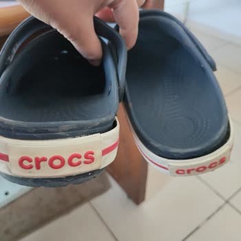 Crocs Terliklerim Beklenmedik Şekilde Parçalandı!