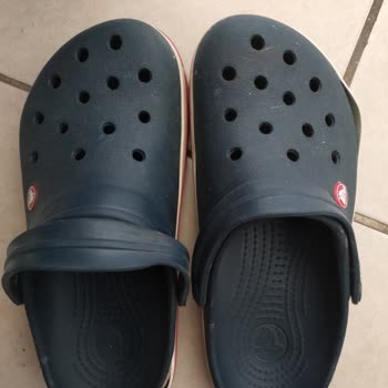 Crocs Terliklerim Beklenmedik Şekilde Parçalandı!