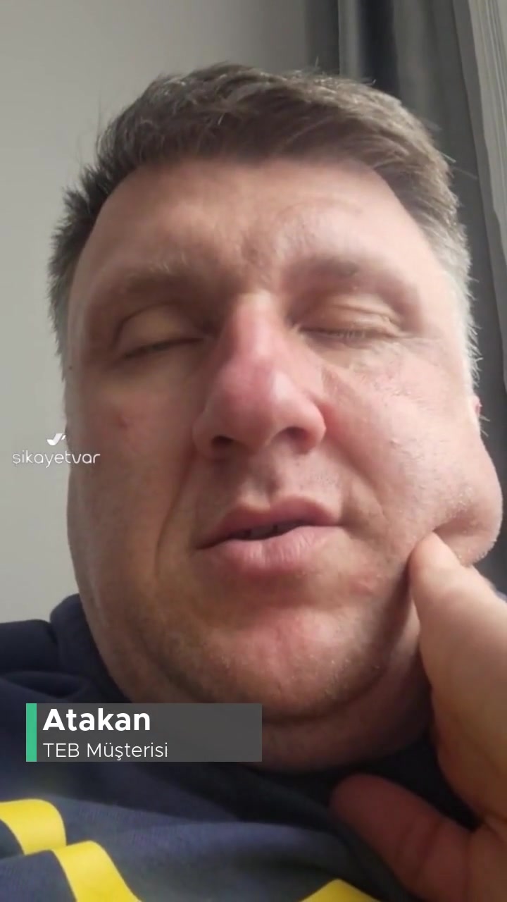 TEB Hadımköy Şubesine Ulaşamıyorum videonun kapak resmi