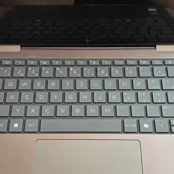 HP İle Yaşadığım 4 Aylık Mağduriyet