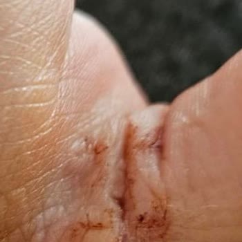 Yetersiz Tıbbi Hizmet Ve Yüksek Ücretler