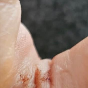 Yetersiz Tıbbi Hizmet Ve Yüksek Ücretler